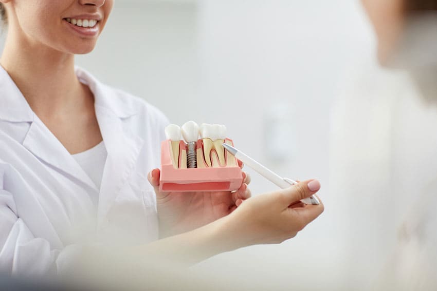 Implantología dental y los seguros dentales